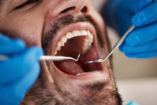 Best Full Mouth Reconstruction  in Carol Stream, IL
