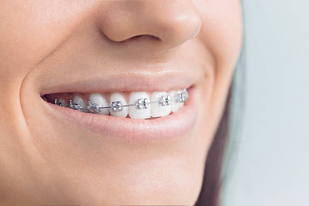 Best Periodontal (Gum) Disease Treatment  in Carol Stream, IL